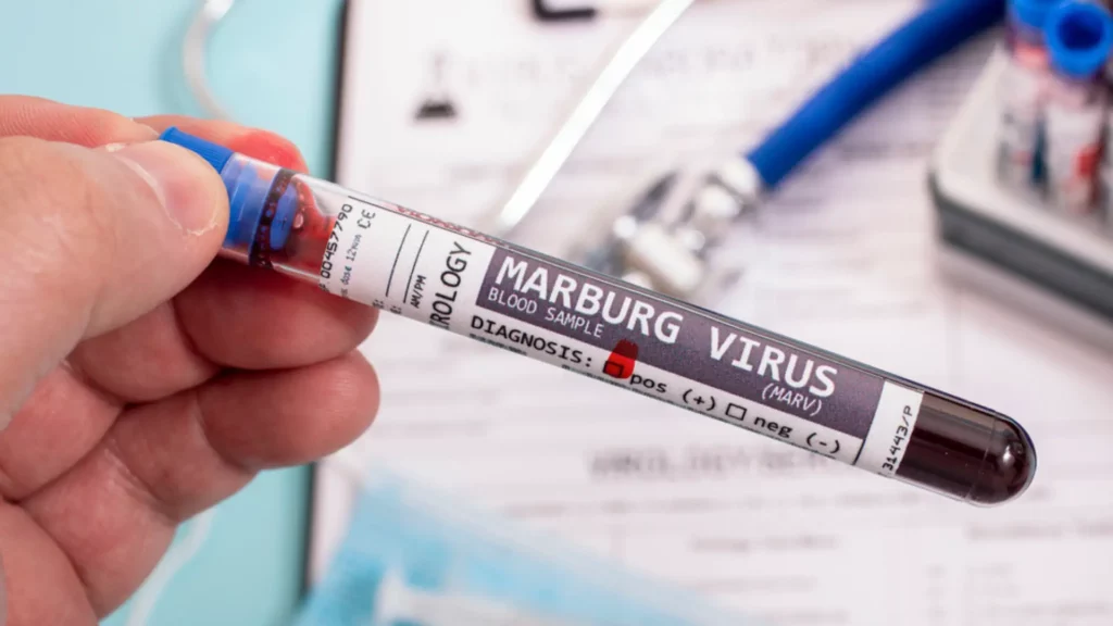 Deadly Marburg Virus Sparks Panic in Germany After Rwanda Outbreak Claims 9 Lives