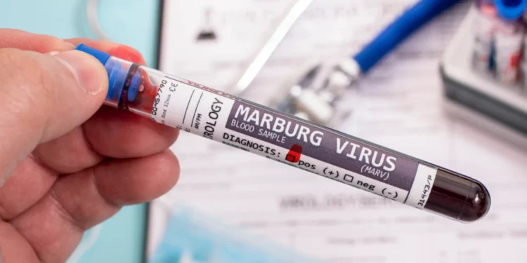 Deadly Marburg Virus Sparks Panic in Germany After Rwanda Outbreak Claims 9 Lives